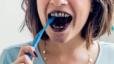 Posso passar carvão nos dentes?