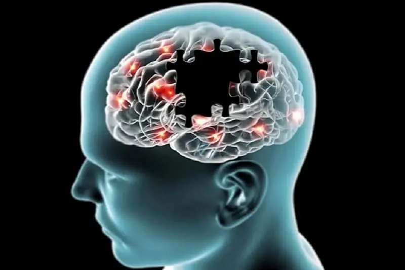 Descubra sinais de Alzheimer em minutos com este teste
