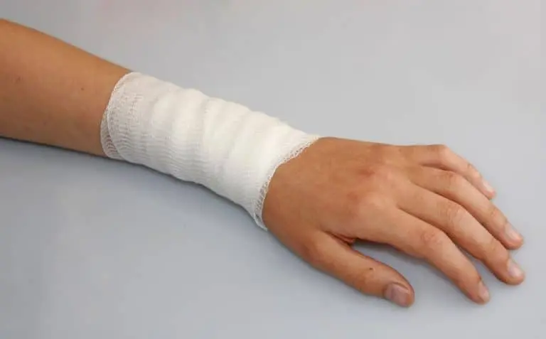 Veja como funciona método inovador para curar queimaduras