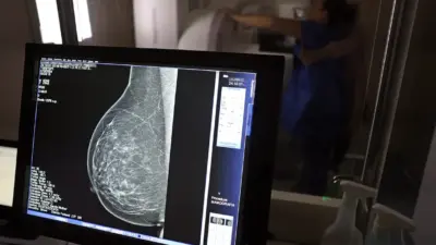 Mamografia sem dor? 7 dicas certeiras para passar por esse exame com menos desconforto