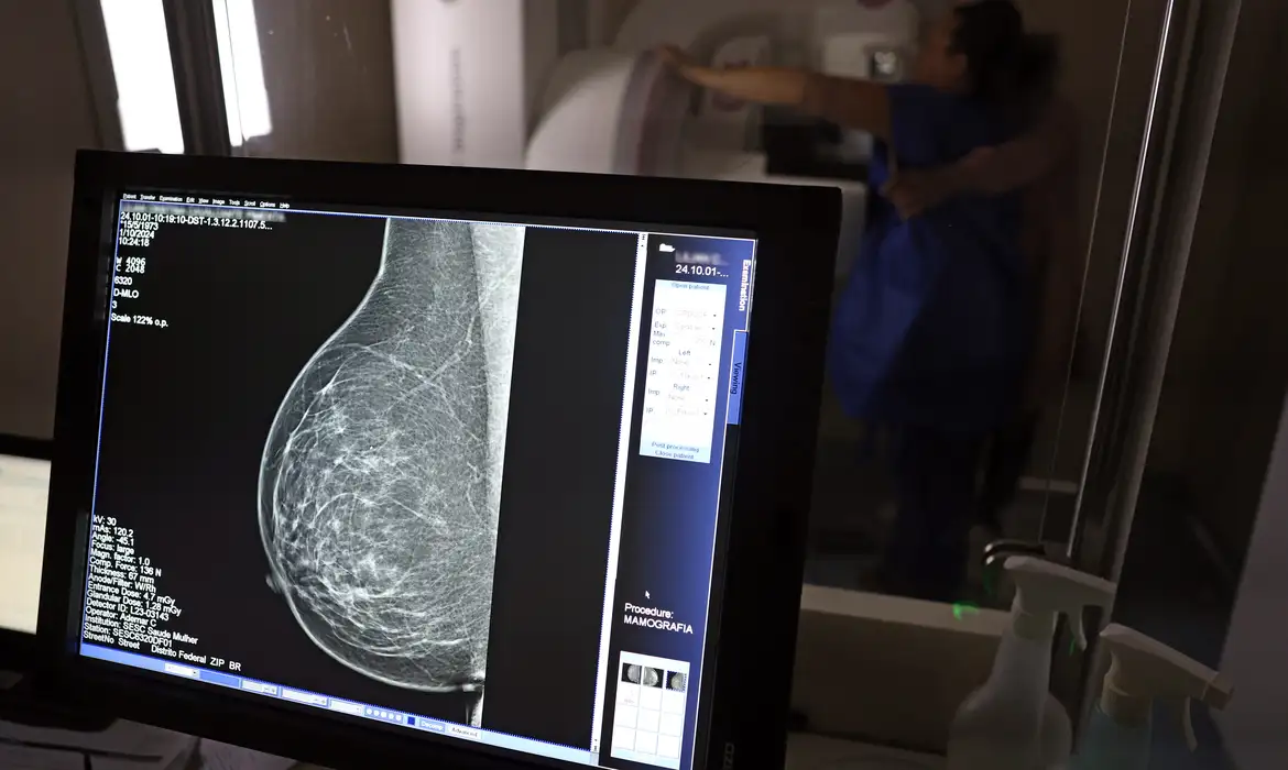 Mamografia sem dor? 7 dicas certeiras para passar por esse exame com menos desconforto